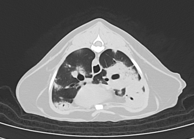 Lungs on CT