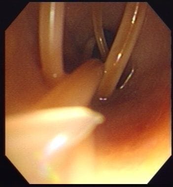 Gastrointestinal endoscopy and colonoscopy at Cat Specialist Services