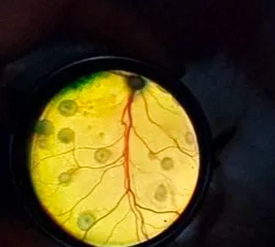 back of a cat's eye (fundus)