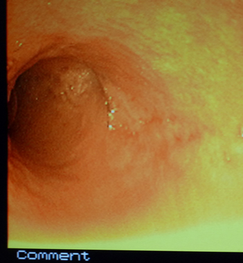 Gastrointestinal endoscopy and colonoscopy at Cat Specialist Services Gastrointestinal endoscopy and colonoscopy at Cat Specialist Services