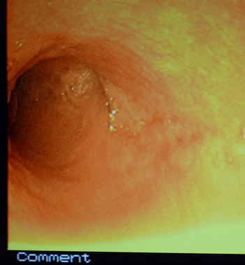 Gastrointestinal endoscopy and colonoscopy at Cat Specialist Services