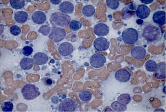 Fine needle aspiration at Cat Specialist Services Fine needle aspiration at Cat Specialist Services