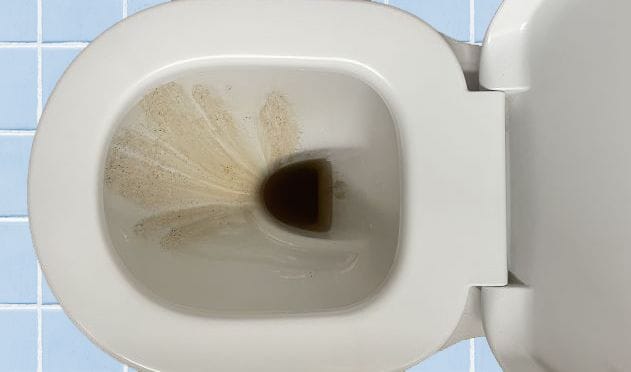Eliminating Rust Stains From Your Toilets