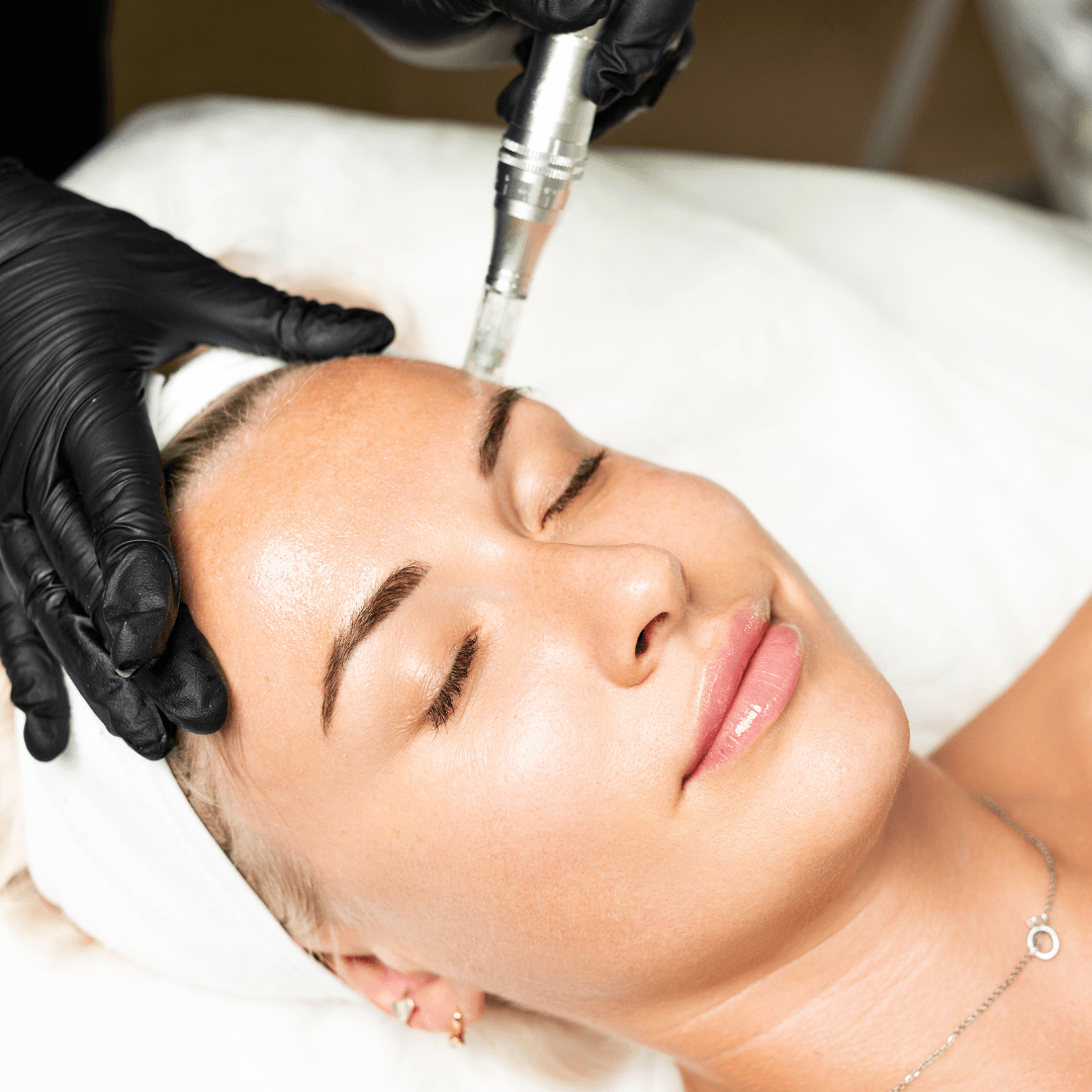 What To Know Before Booking Microneedling & Skin Rejuvenation Sessions