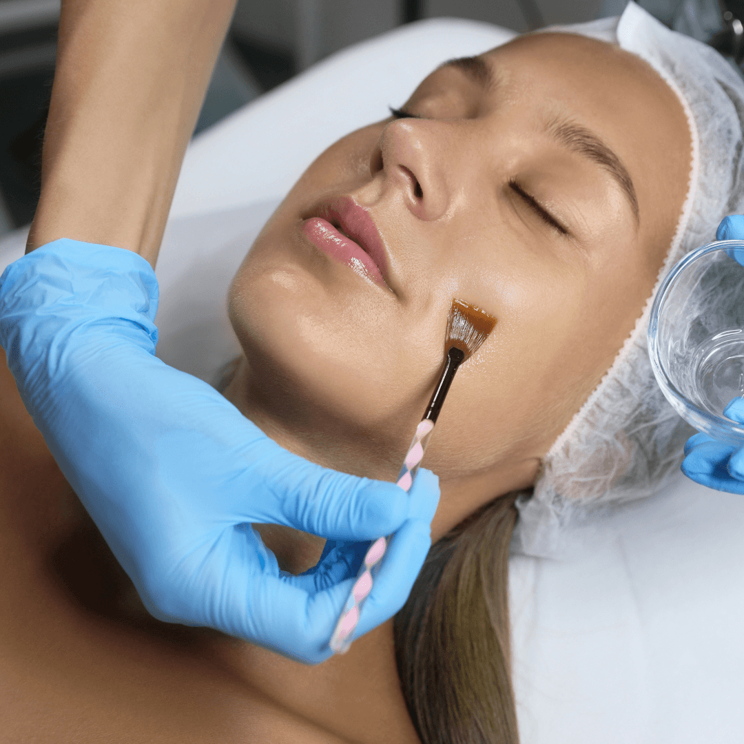 How Chemical Peels & Medical Facials Can Transform Dry Winter Skin How Chemical Peels & Medical Facials Can Transform Dry Winter Skin
