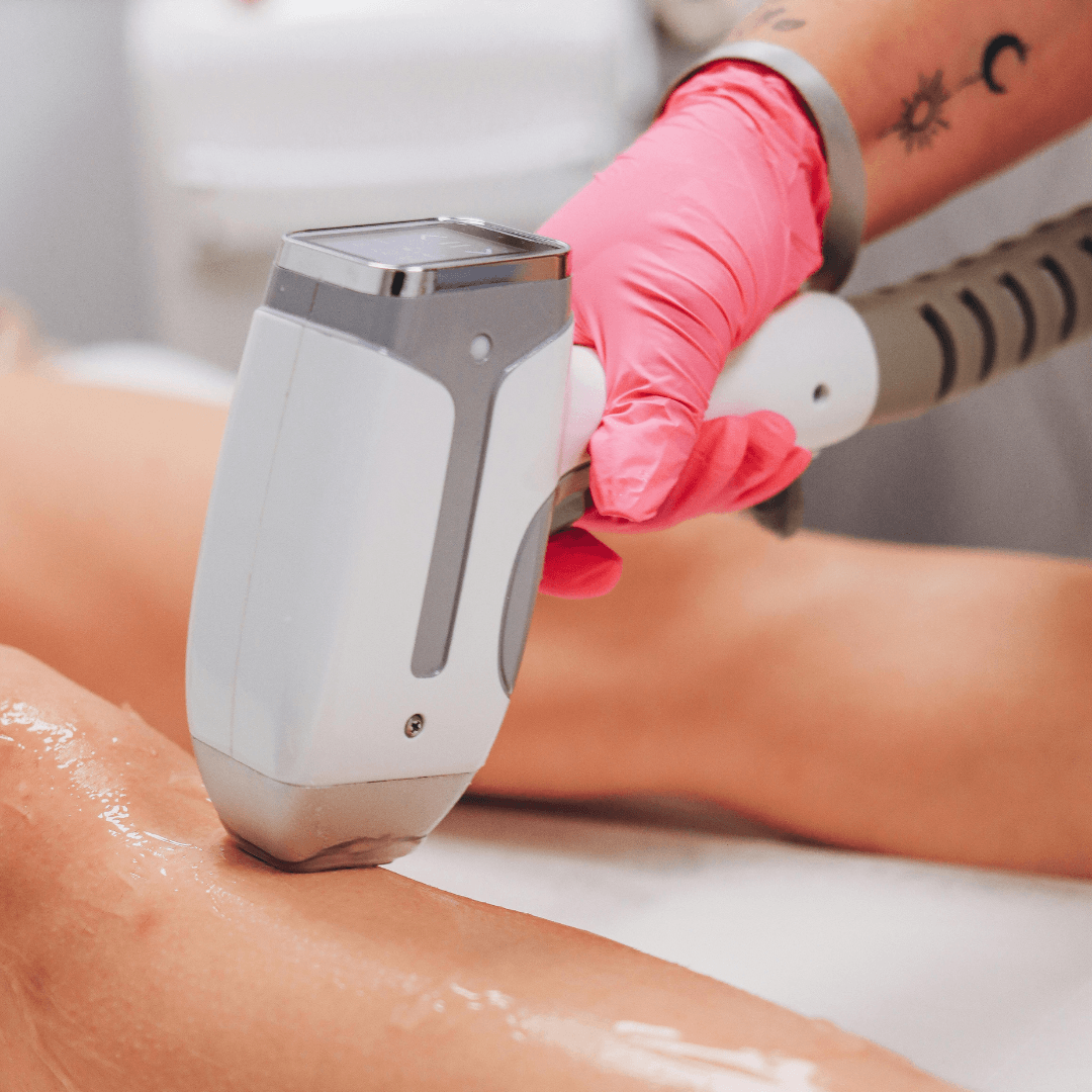 Why Laser Hair Removal Is a Game-Changer Why Laser Hair Removal Is a Game-Changer