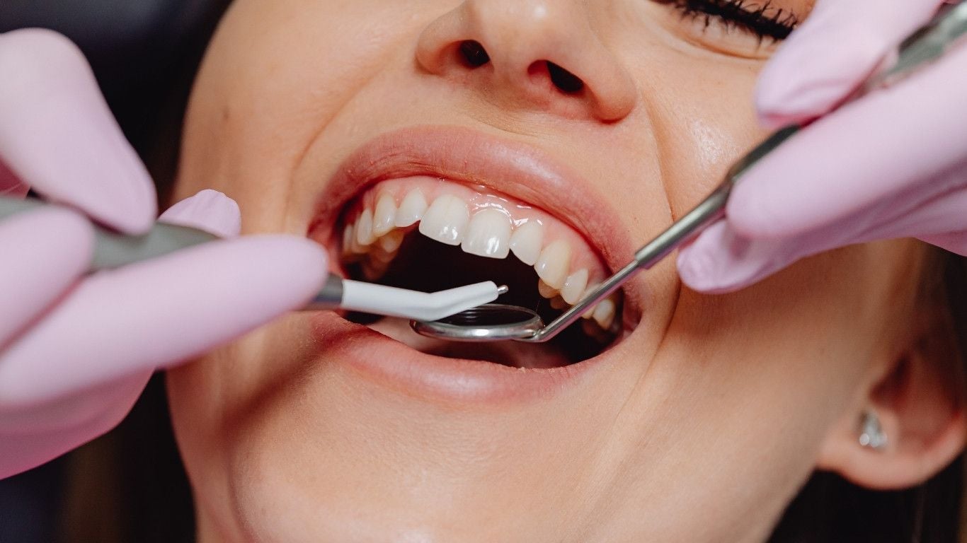 Do Root Canals Hurt? Debunking Common Myths About Endodontic Treatment