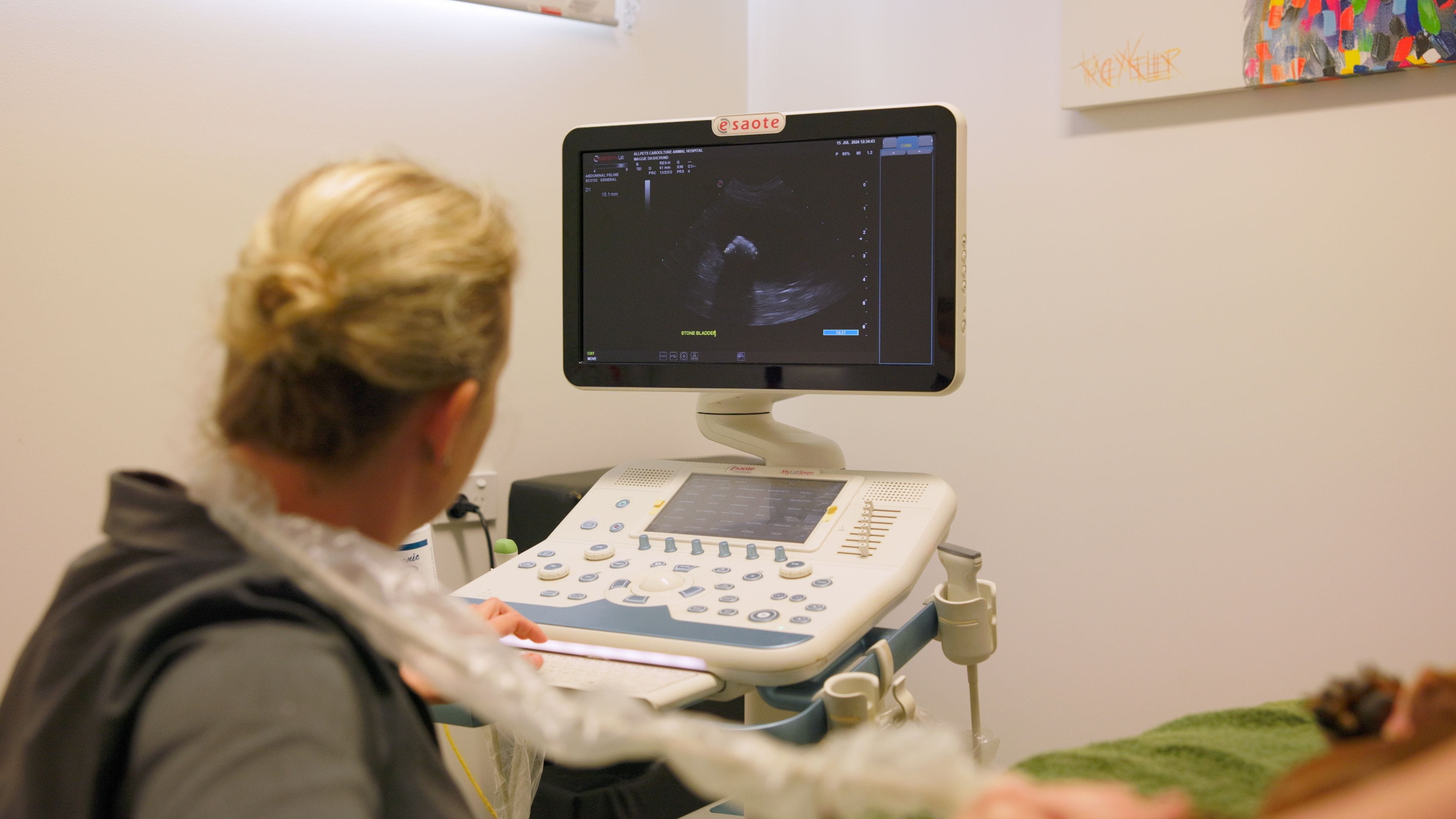 Ultrasonography