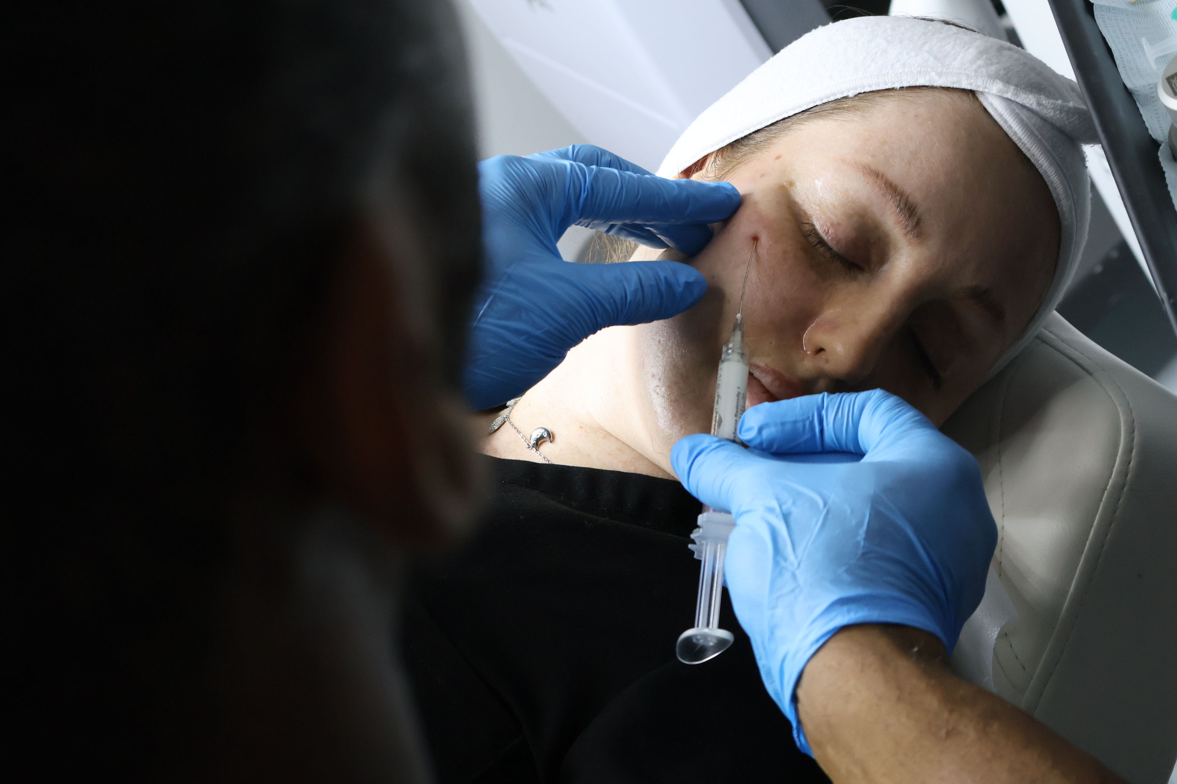 Fillers - Injectable Dr. Laurent Laval