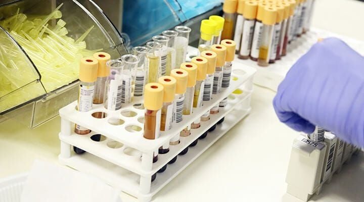 Pre-Anaesthetic Blood Testing: A Gold Standard of Care Pre-Anaesthetic Blood Testing: A Gold Standard of Care