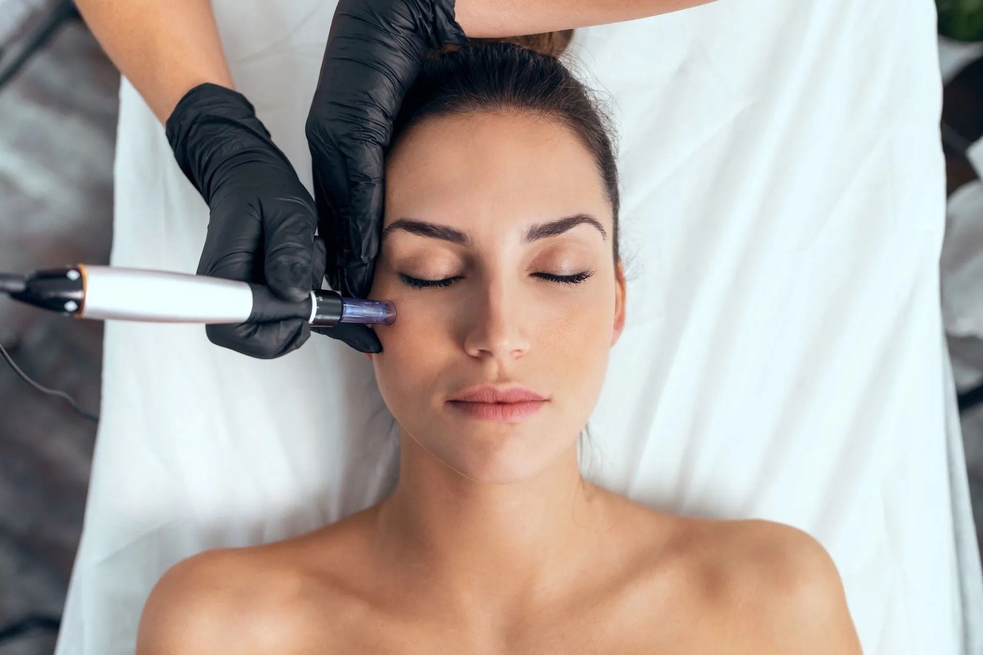 The Power of Microneedling: Stimulating Collagen Production for a Youthful Glow The Power of Microneedling: Stimulating Collagen Production for a Youthful Glow
