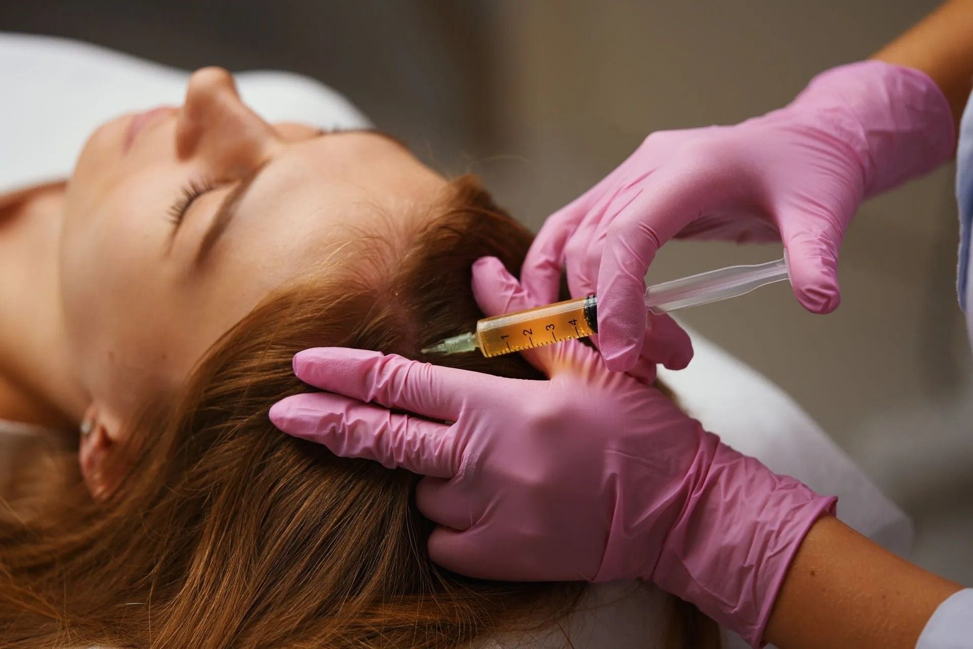 PRP Therapy: The Natural Solution for Hair Loss and Skin Rejuvenation at Visage Rejuvenation Clinic PRP Therapy: The Natural Solution for Hair Loss and Skin Rejuvenation at Visage Rejuvenation Clinic