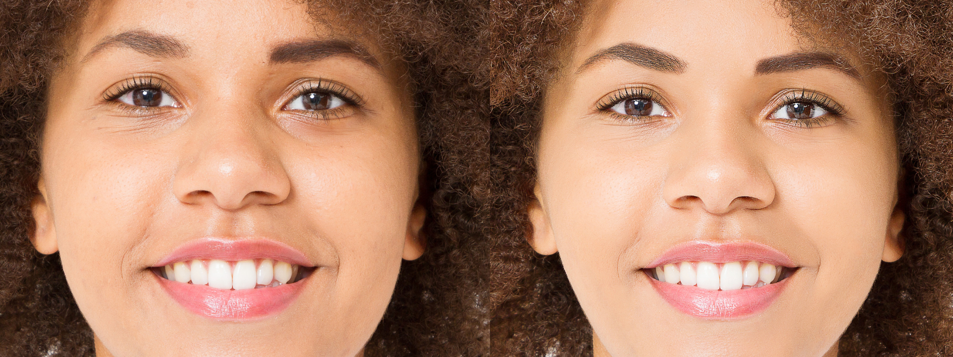 Aging Gracefully: Preventative Aesthetic Treatments in Your 30s, 40s, and 50s