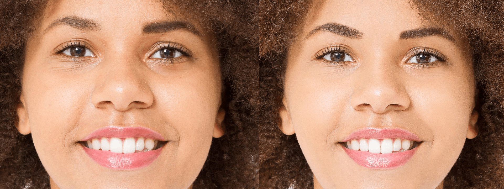 Aging Gracefully: Preventative Aesthetic Treatments in Your 30s, 40s, and 50s Aging Gracefully: Preventative Aesthetic Treatments in Your 30s, 40s, and 50s