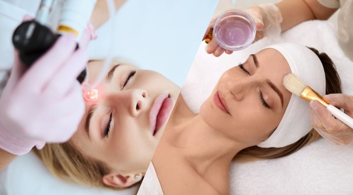 Laser Peel vs Chemical Peel: How to Choose the Right Skin Resurfacing Treatment