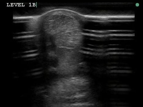 Equine Ultrasonography Equine Ultrasonography
