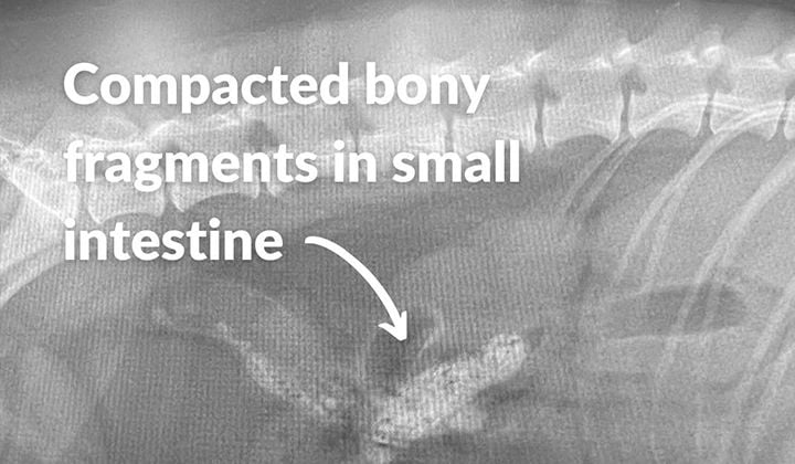 Can a Swallowed Foreign Object Be Removed Without Surgery? Can a Swallowed Foreign Object Be Removed Without Surgery?