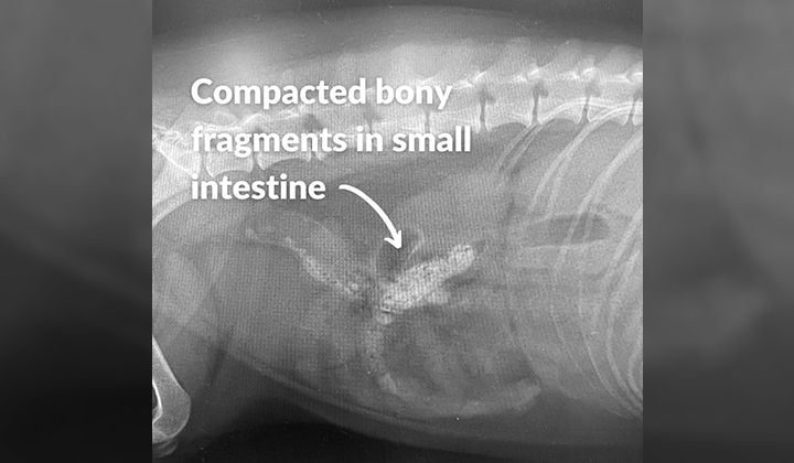 Can a Swallowed Foreign Object Be Removed Without Surgery? Can a Swallowed Foreign Object Be Removed Without Surgery?