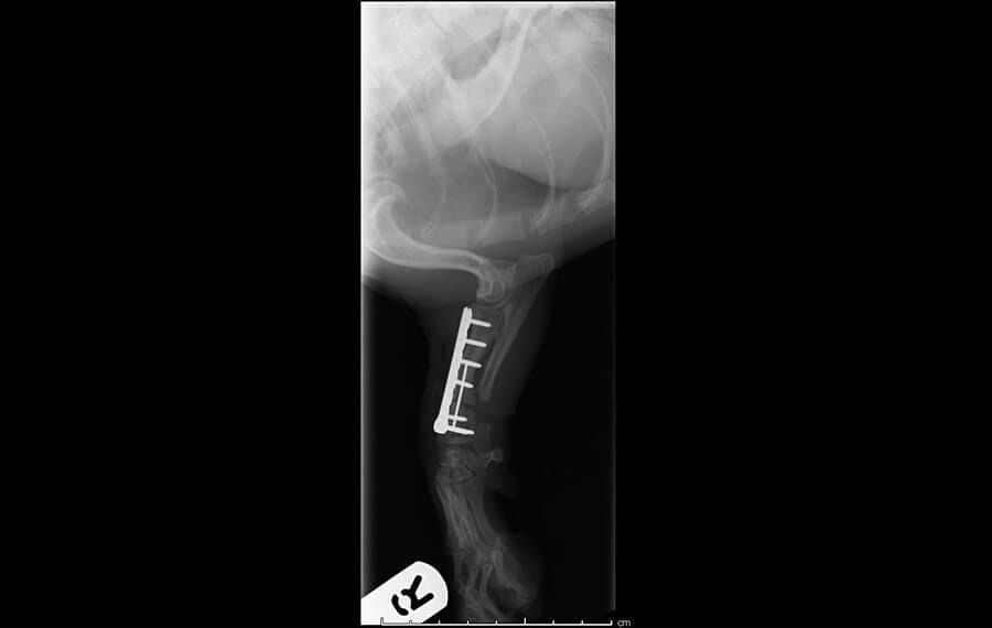 Joint (articular) Fractures