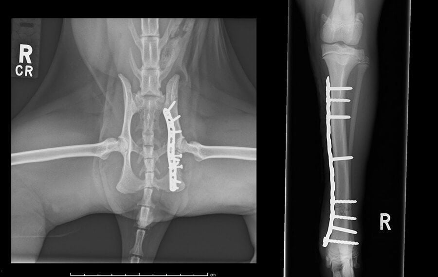 Internal Fixation