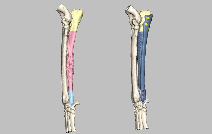 3D-Printed Endoprosthesis Replacement