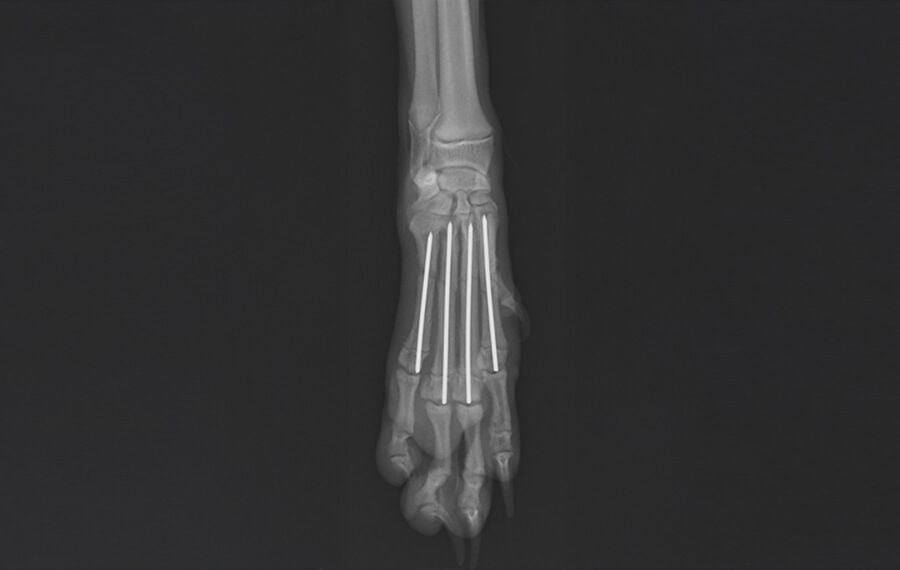 Minimally Invasive fracture repair