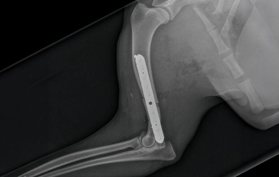 Fracture Repair & Trauma Reconstruction Fracture Repair & Trauma Reconstruction