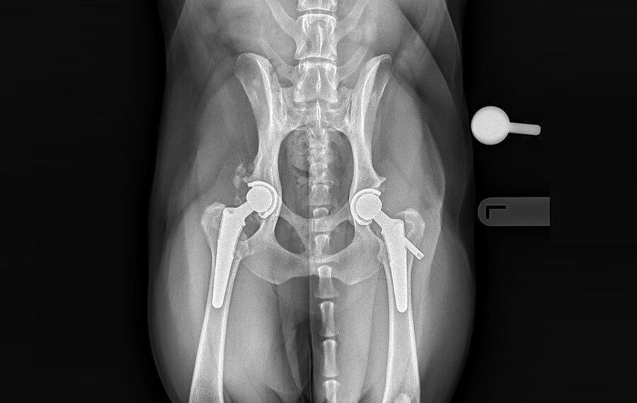 Total Hip Replacement