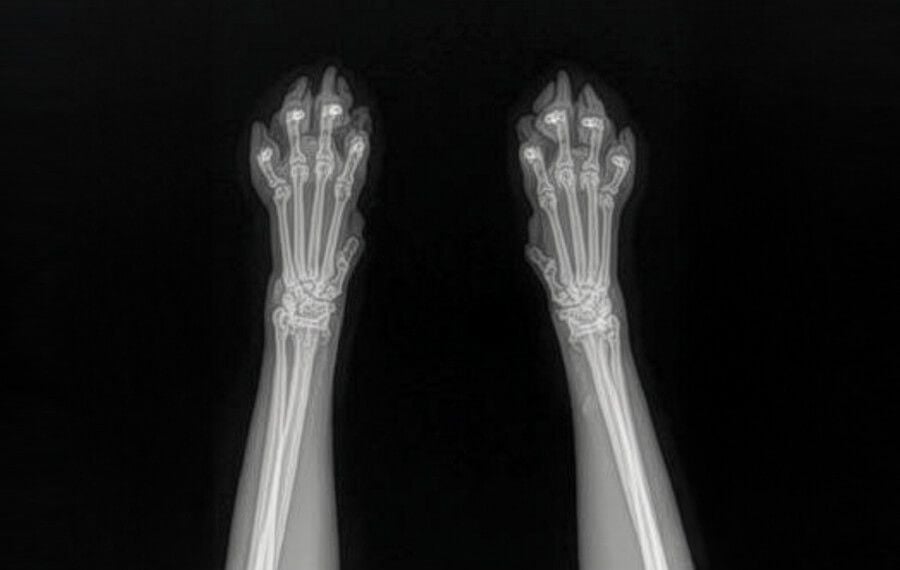 Carpus (Wrist)