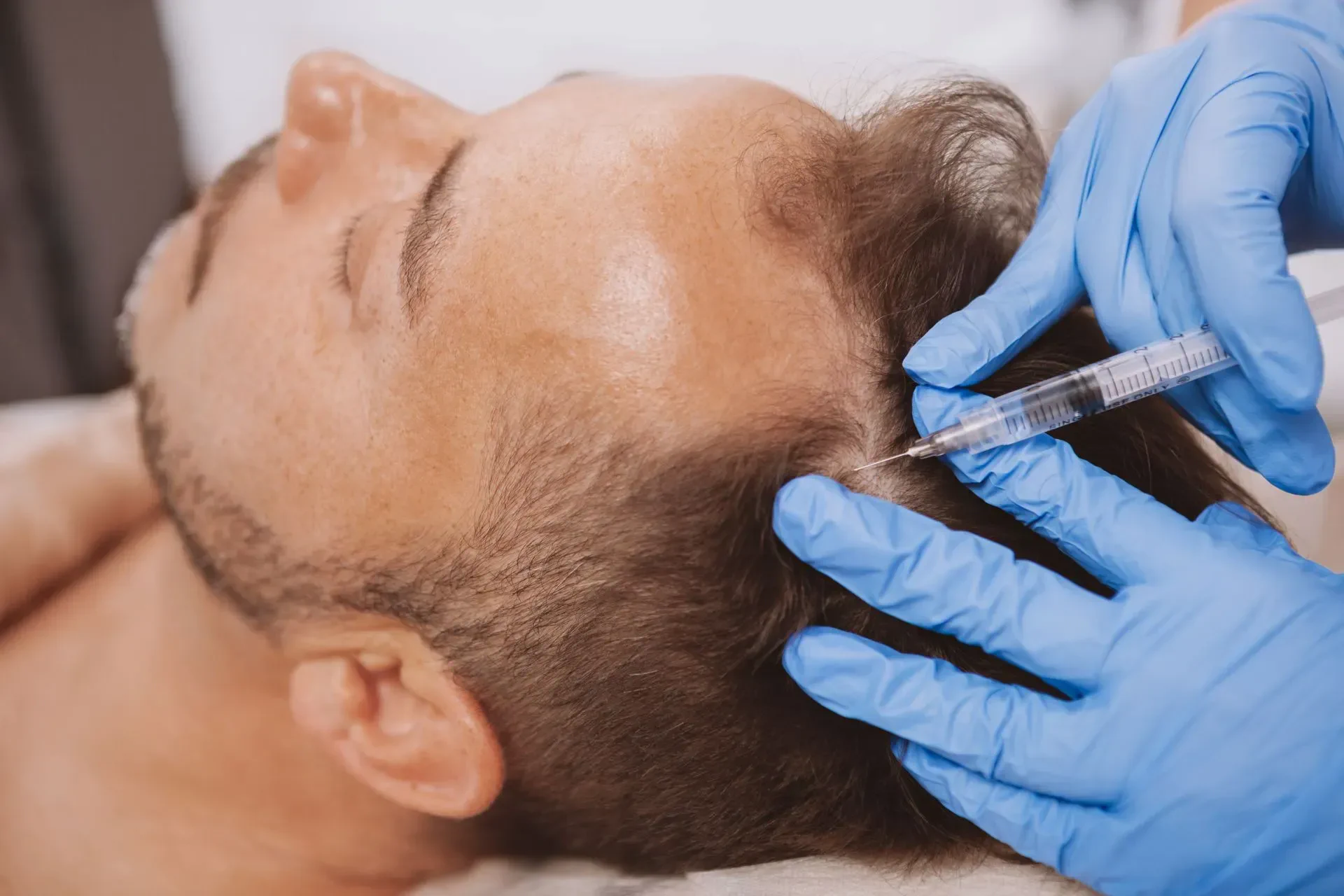 Hair Loss Support: How Platelet-Rich Plasma Can Help Regrow Your Hair