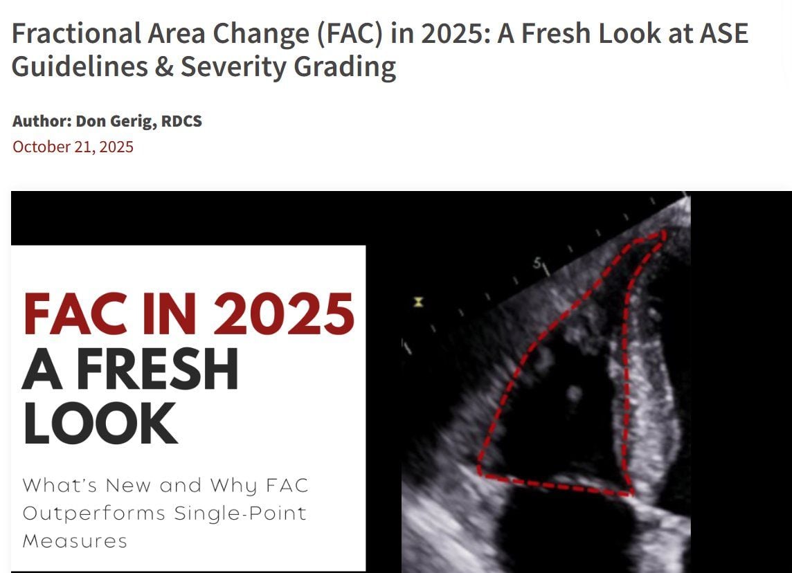 Fractional Area Change (FAC) in 2025: A Fresh Look at ASE Guidelines & Severity Grading
