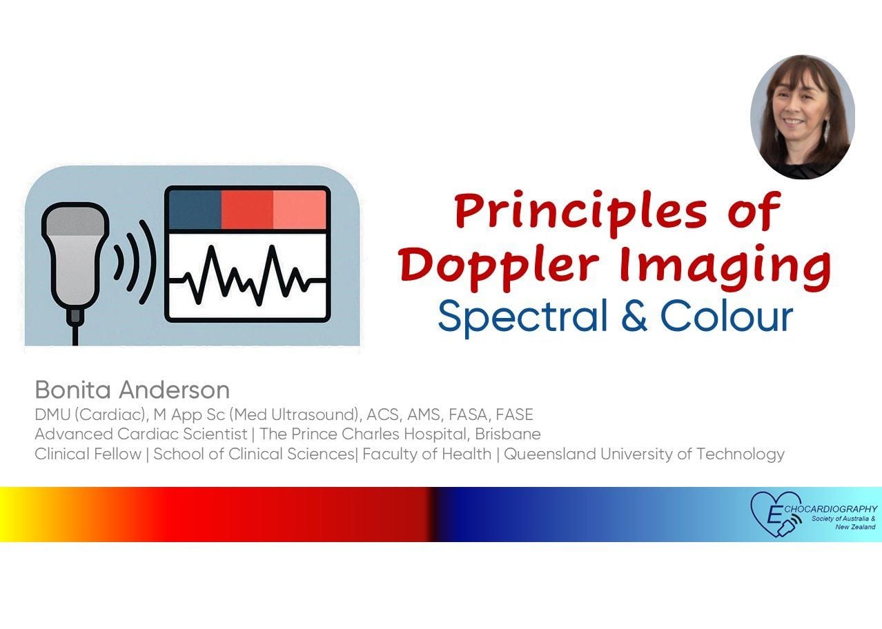Principles of Spectral & Colour Doppler Imaging
