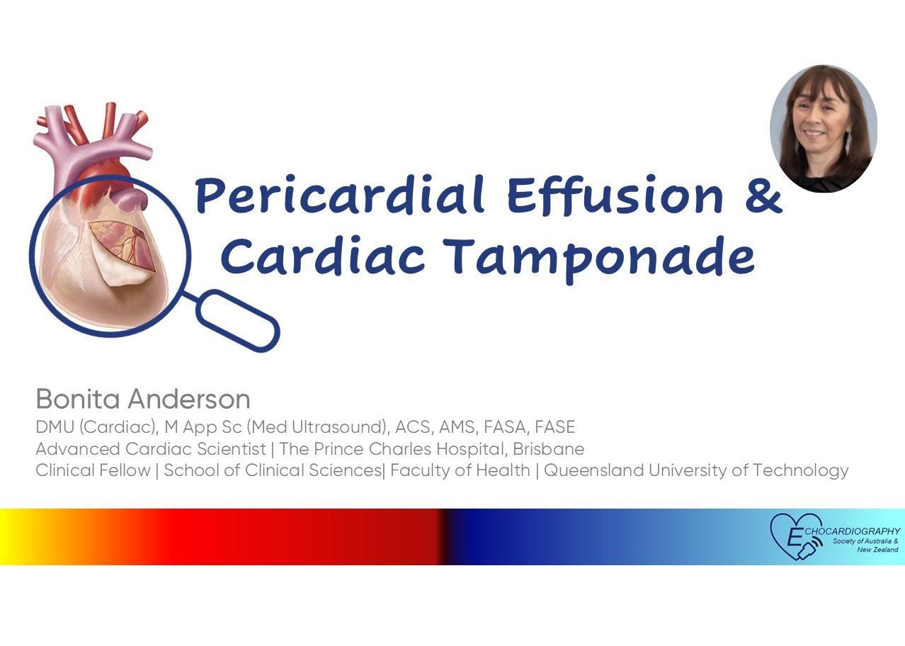 Pericardial Effusion and Cardiac Tamponade