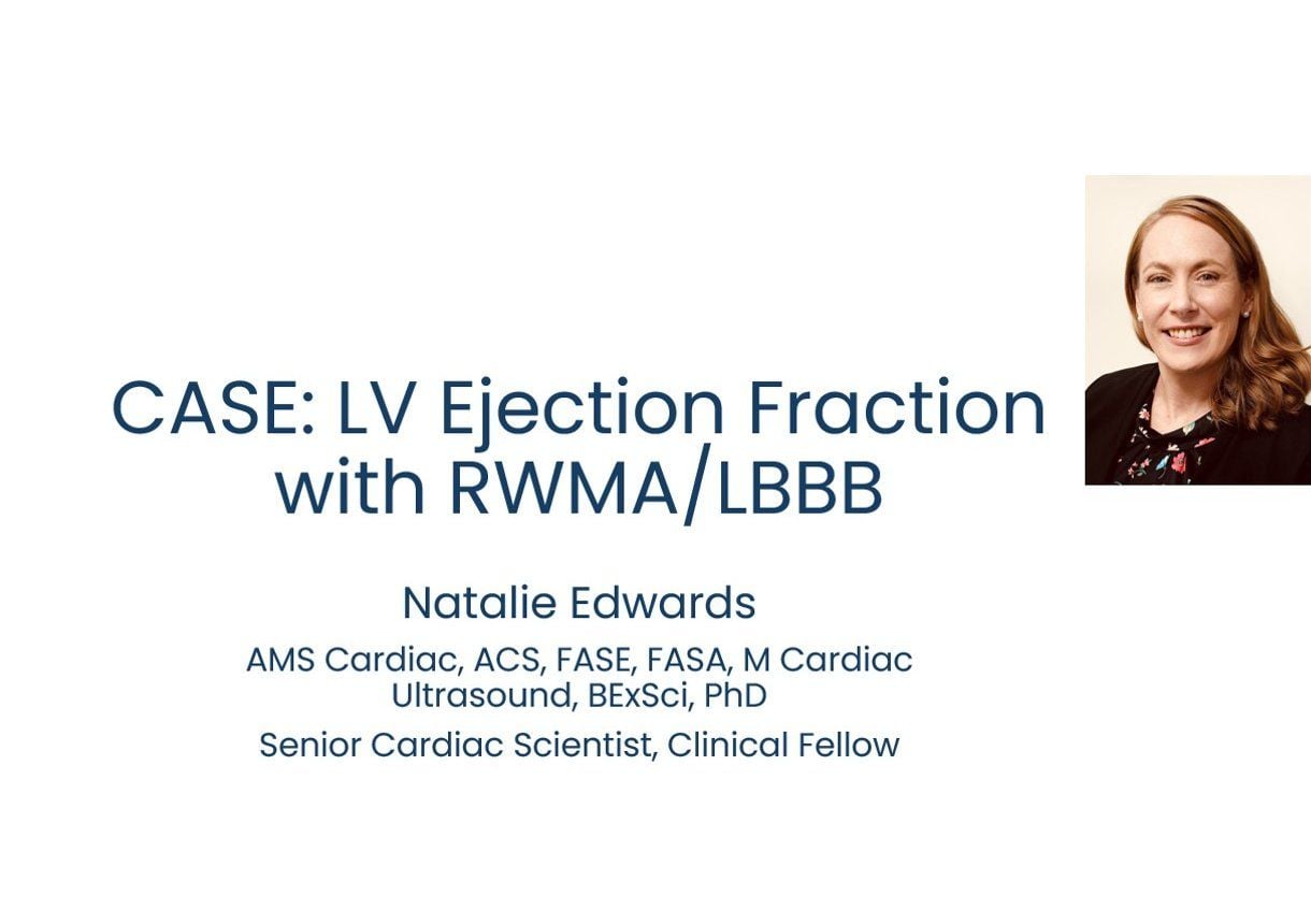 Ejection Fraction in LBBB - Case by Dr Natalie Edwards