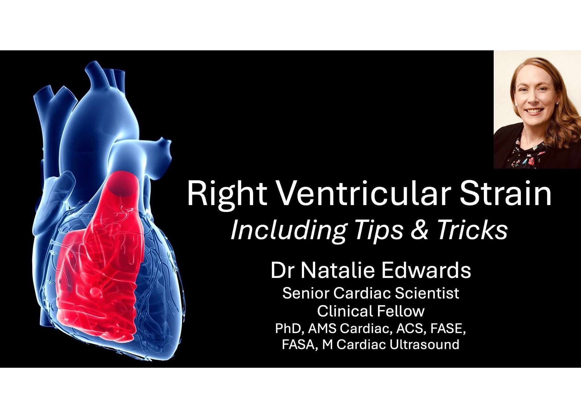 Dr Natalie Edwards discusses Right Ventricular Strain