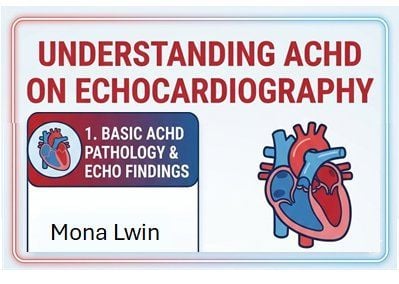 Echocardiography in Adult Congenital Heart Disease: Where Are We Now? Echocardiography in Adult Congenital Heart Disease: Where Are We Now?