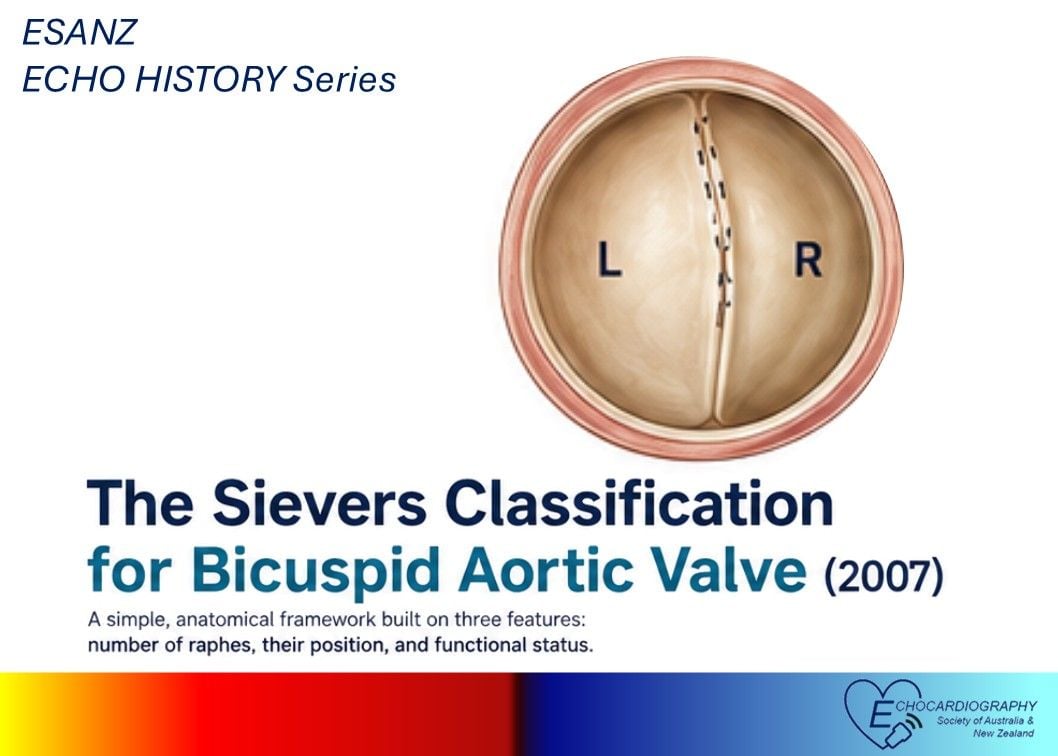 ESANZ History Series: The Sievers Classification 2007