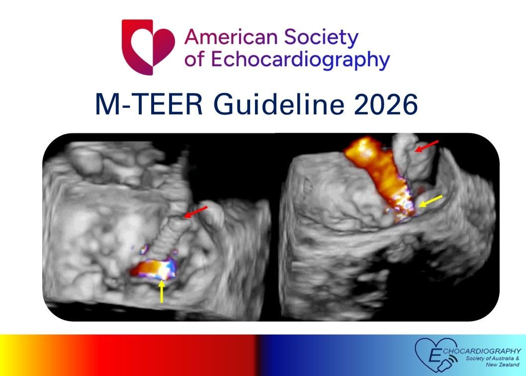 ESANZ endorses the American Society of Echocardiography M-TEER Guideline