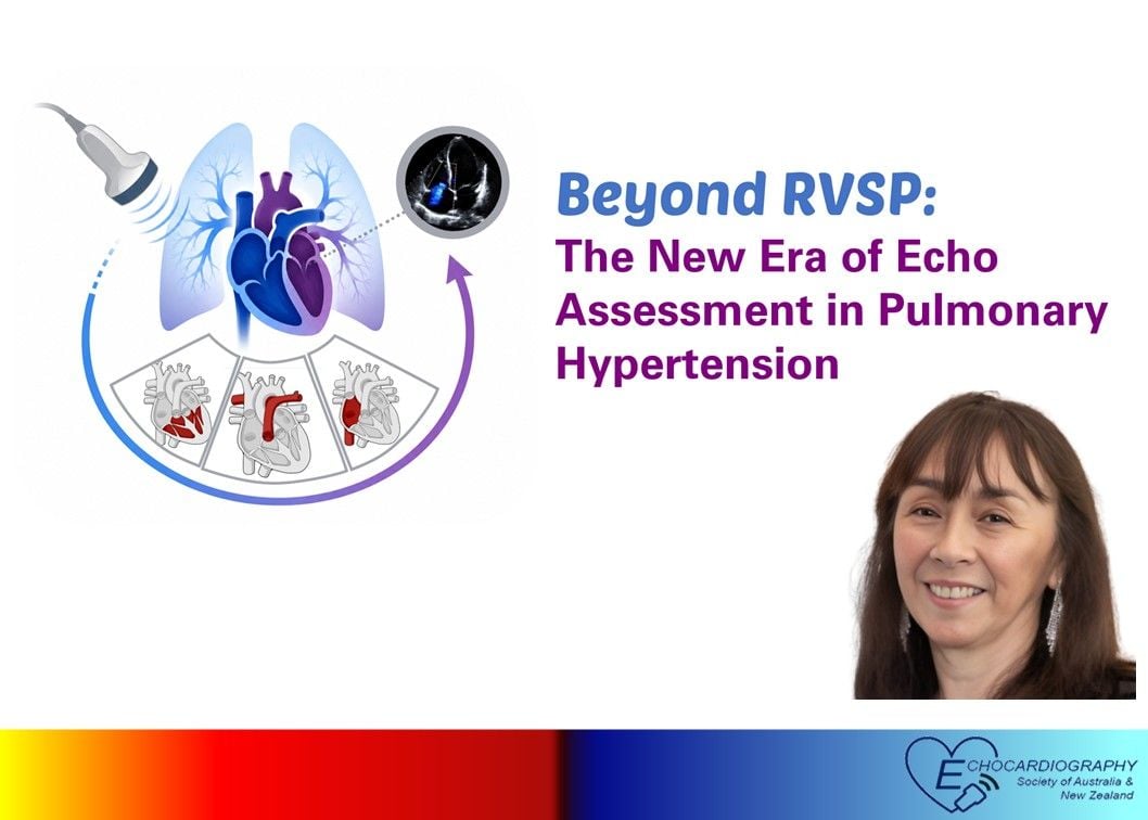Beyond RVSP: The New Era of Echo Assessment in Pulmonary Hypertension