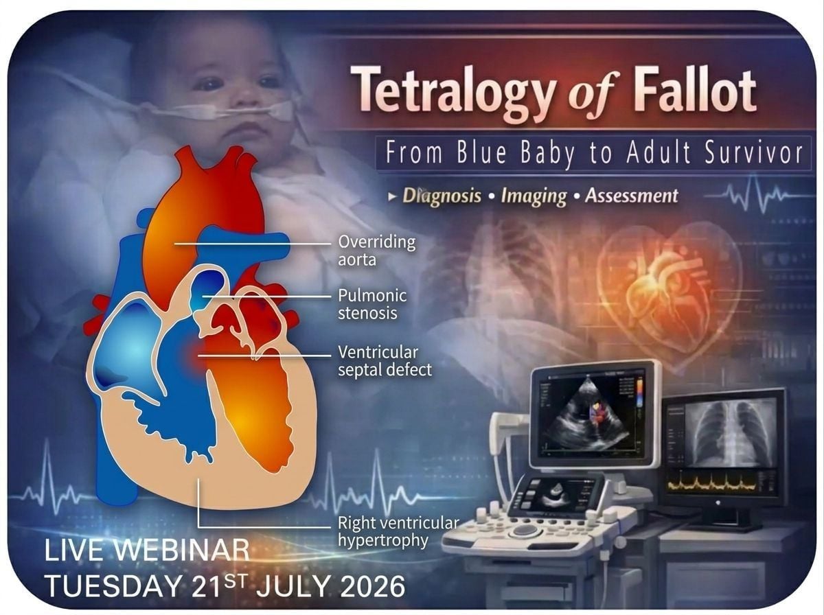 TETRALOGY OF FALLOT: FROM BLUE BABY TO ADULT SURVIVOR