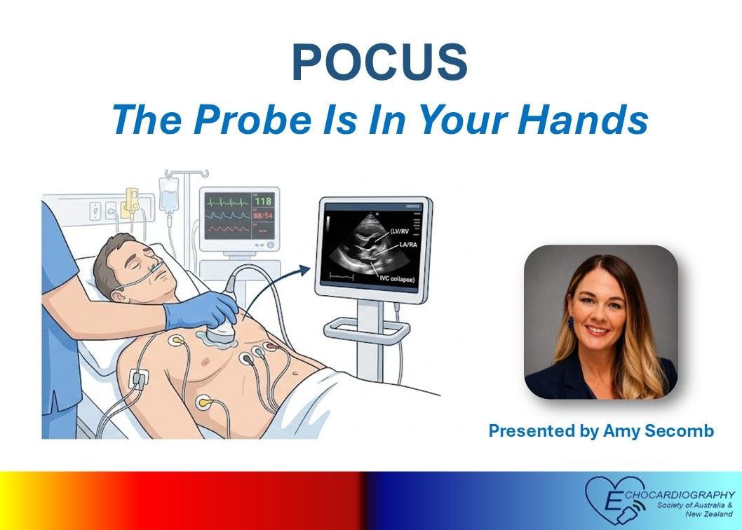 Cardiac POCUS - The probe belongs in your hands! Cardiac POCUS - The probe belongs in your hands!