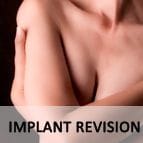 Implant Revision