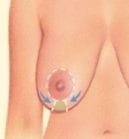 Around the areola