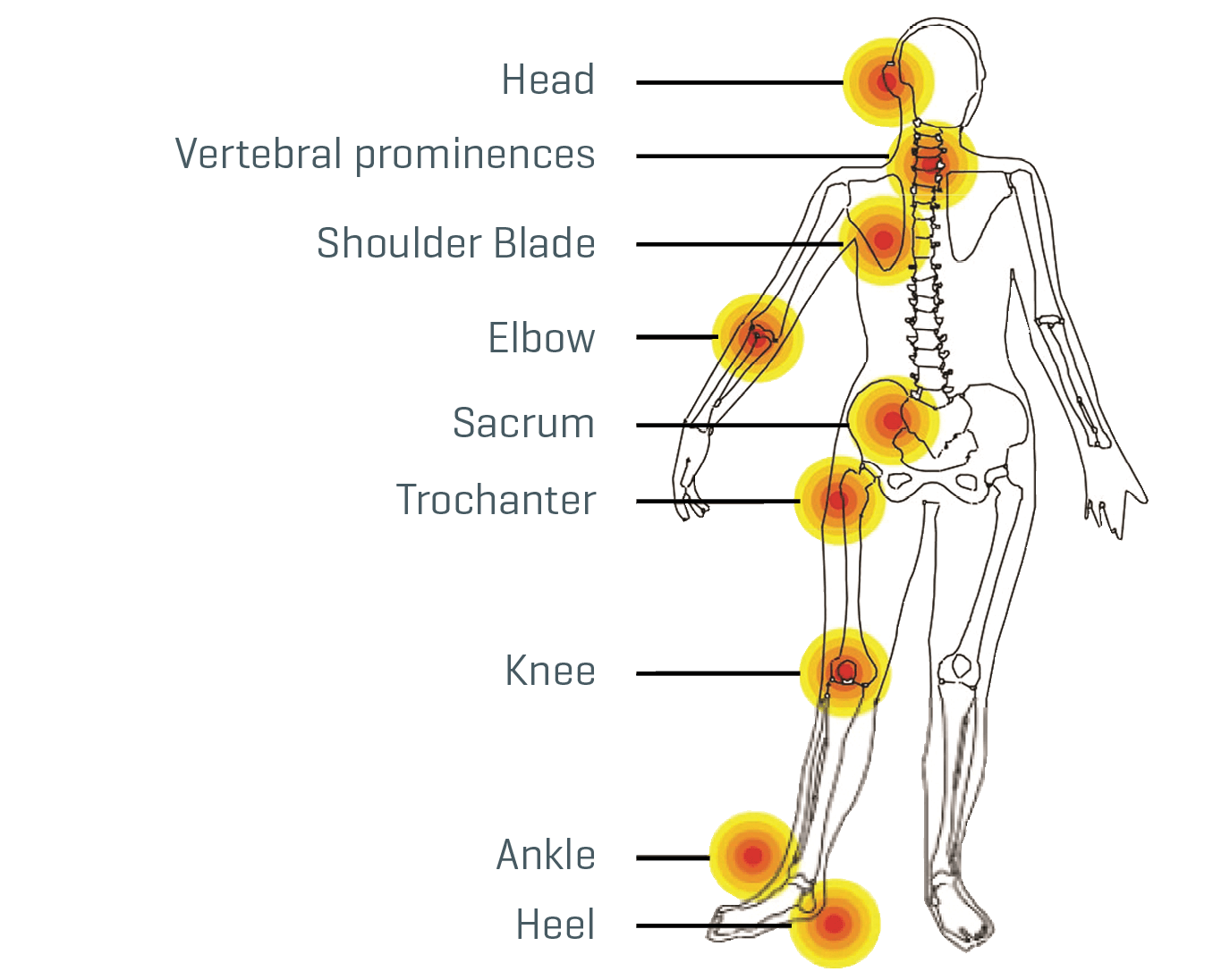 Vacuform Patient Positioning System