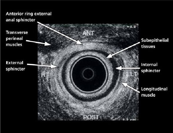 External Anal Sphincter