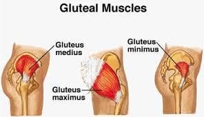 What Is Gluteal Tendinopathy and Why Is It Common in Women?