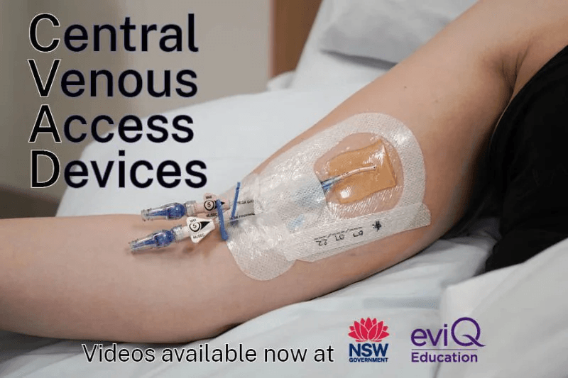 Central Venous Access Devices