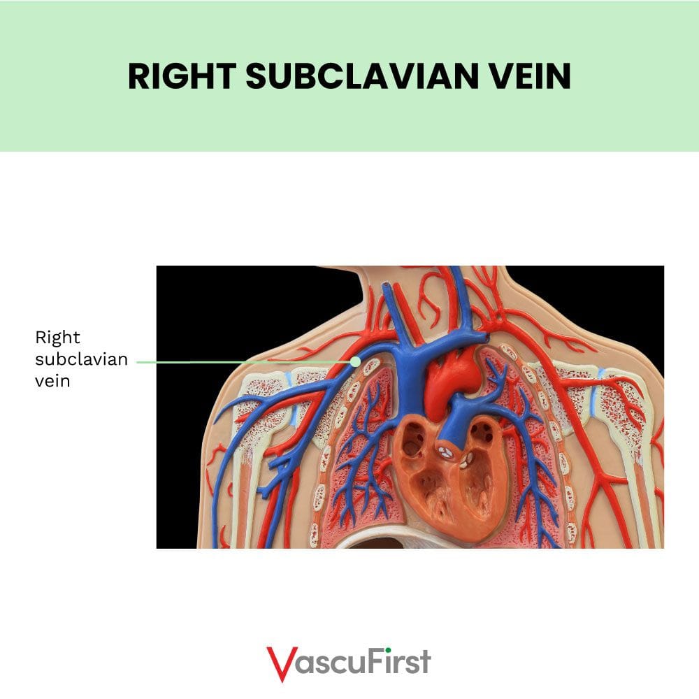 subclavian vein heart