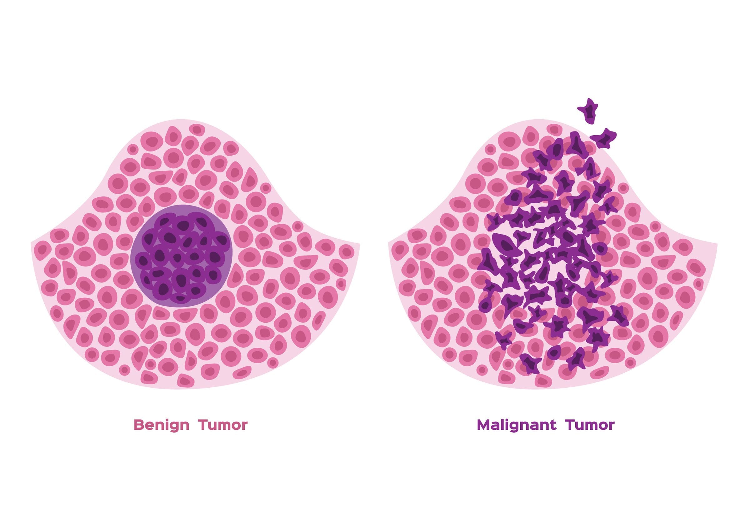 Cancer Cells vs. Normal Cells: How Are They Different?