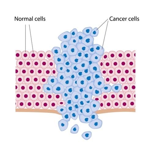 How does cancer do that? Sizing up cells and their shapes